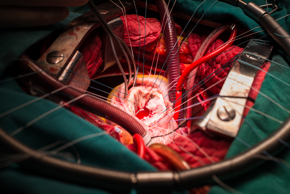 Cardiothoracic Surgery Photo